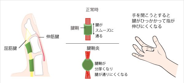 画像に alt 属性が指定されていません。ファイル名: 111.jpg